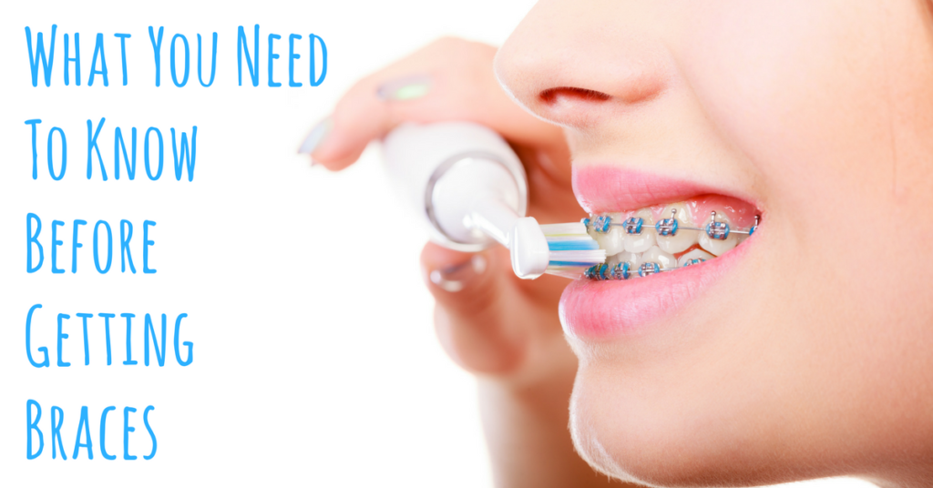 What You Need to Know Before Getting Braces | Pine Tree Dental Care